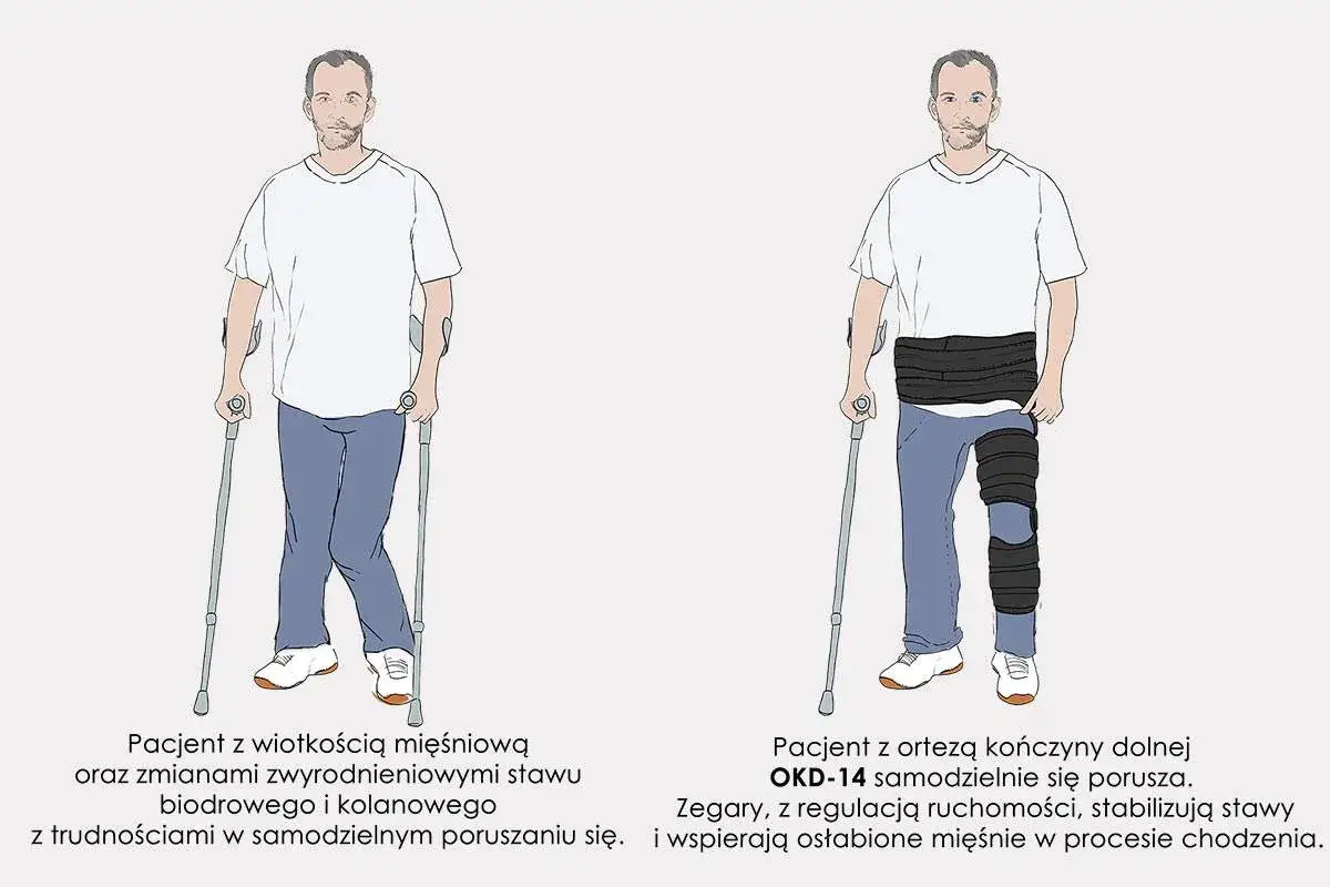 Zdjęcie Jak chodzić w ortezie po schodach bez ryzyka kontuzji i bólu